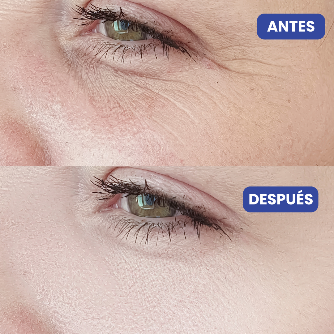 Crema Restauradora para Contorno de Ojos