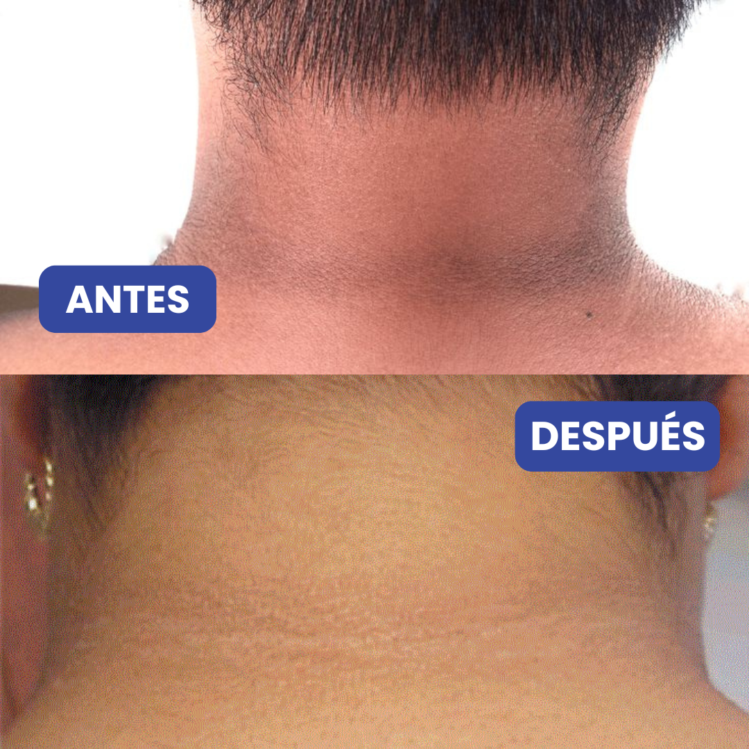Crema para el Cuello: Dermoaclarante e Iluminador