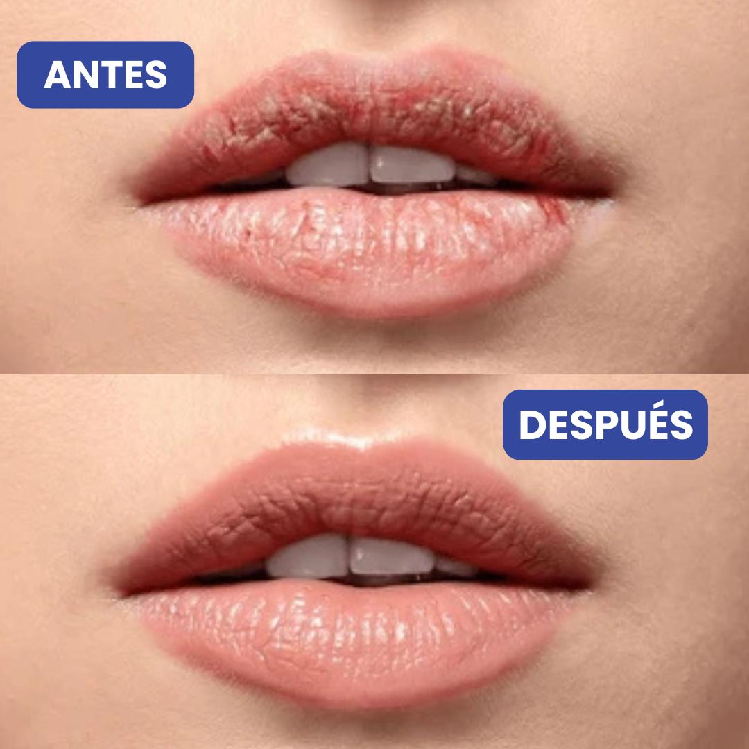 Tratamiento Antienvejecimiento para Labios