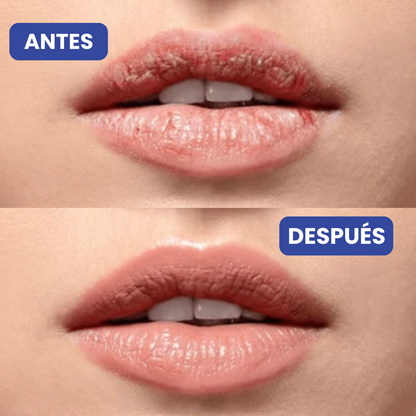 Tratamiento Antienvejecimiento para Labios