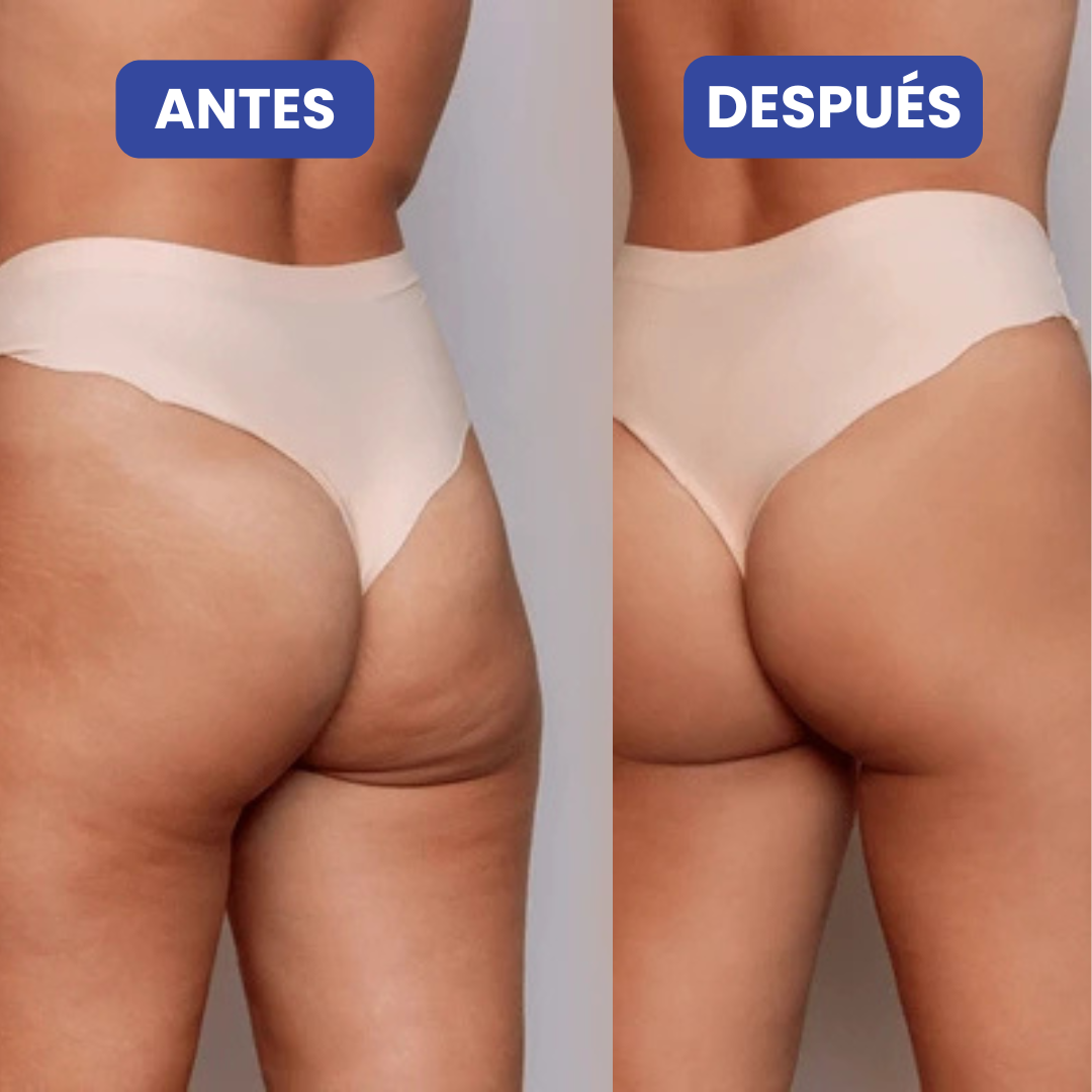 Crema Para Mejorar la Apariencia de Glúteos y Muslos
